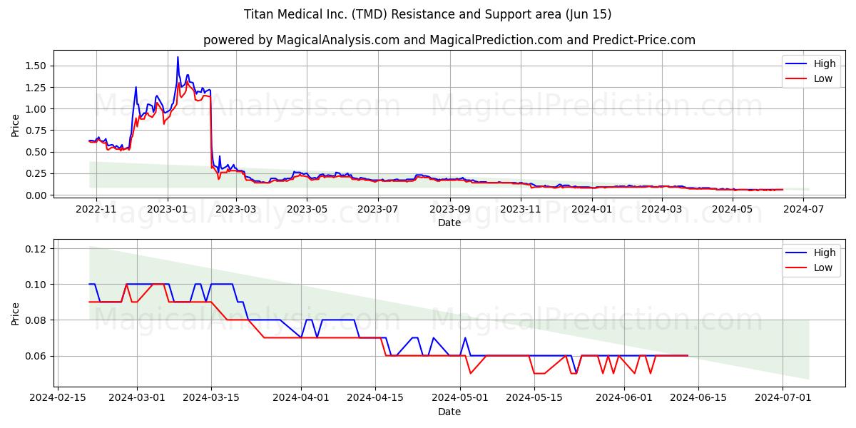 Titan Medical Inc. (TMD) price movement in the coming days