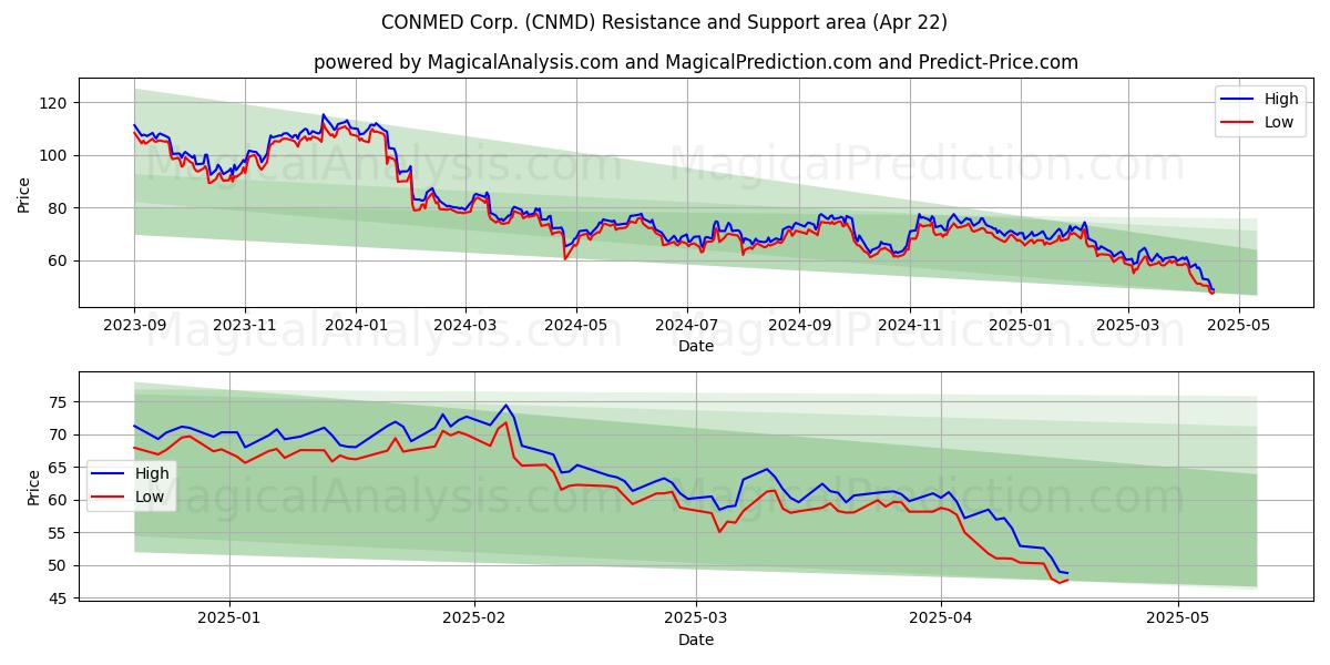  CONMED Corp. (CNMD) Support and Resistance area (22 Apr) 