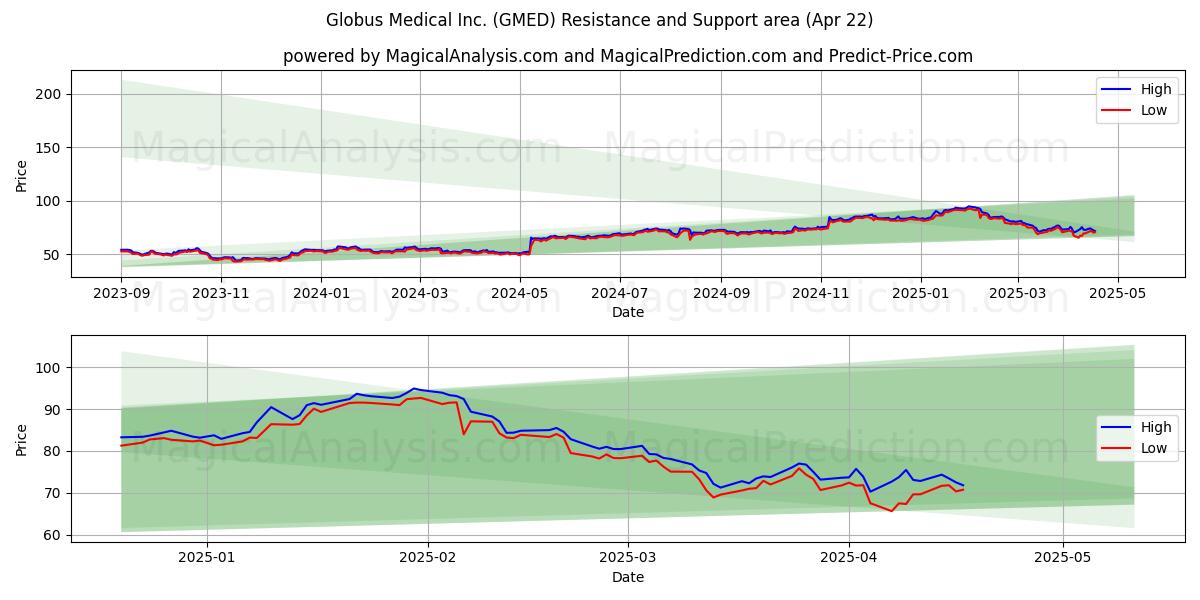  Globus Medical Inc. (GMED) Support and Resistance area (22 Apr) 