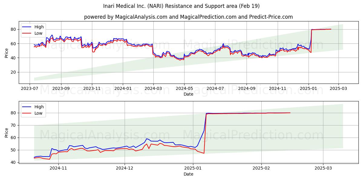  Inari Medical Inc. (NARI) Support and Resistance area (19 Feb) 