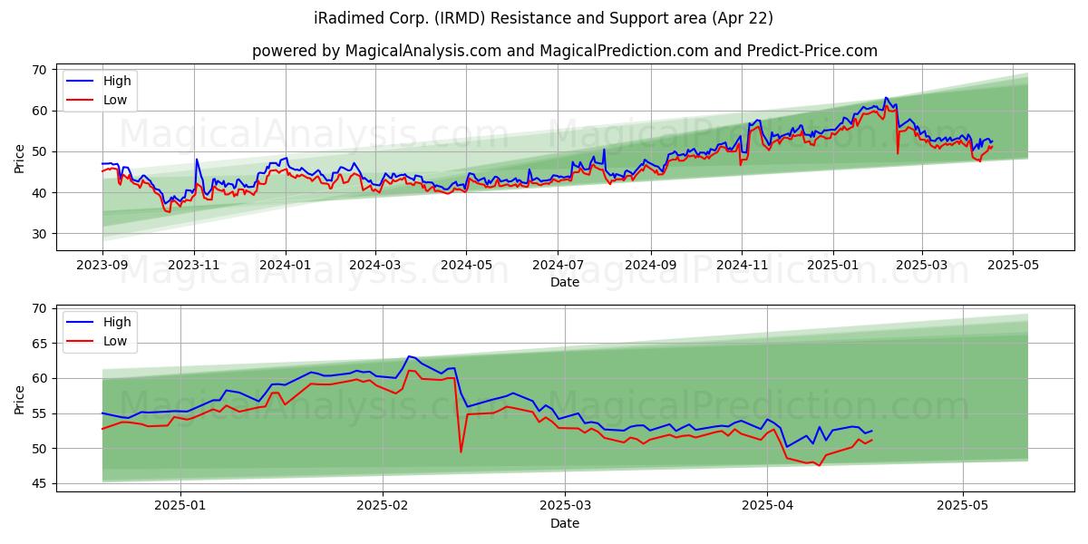  iRadimed Corp. (IRMD) Support and Resistance area (22 Apr) 