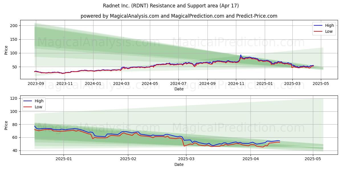 Radnet Inc. (RDNT) Support and Resistance area (17 Apr) 