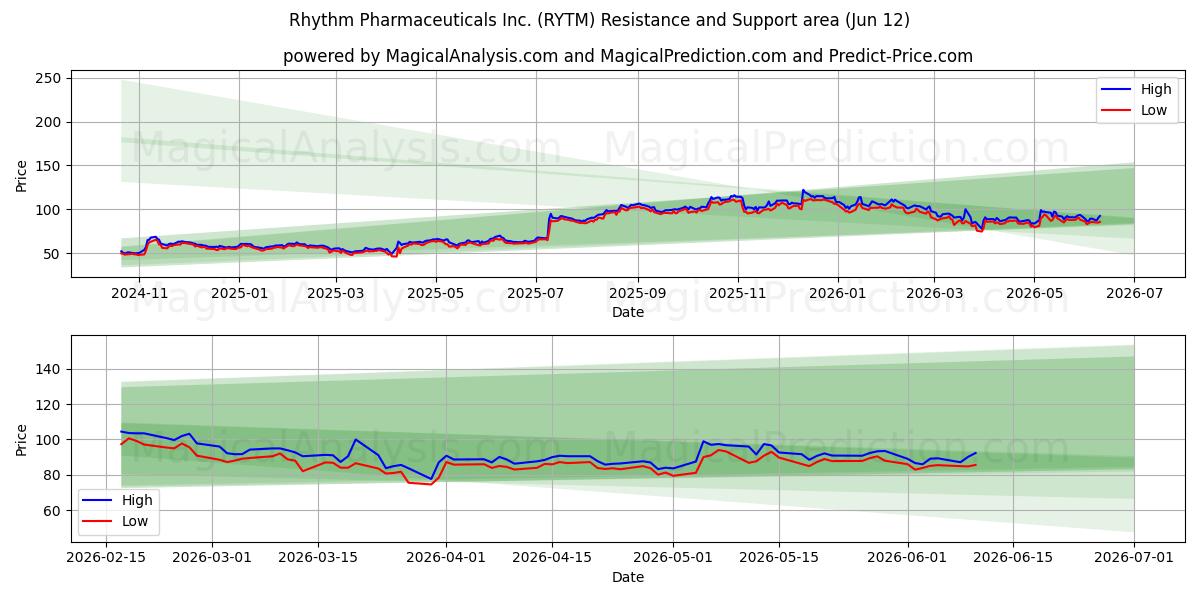  Rhythm Pharmaceuticals Inc. (RYTM) Support and Resistance area (28 May) 
