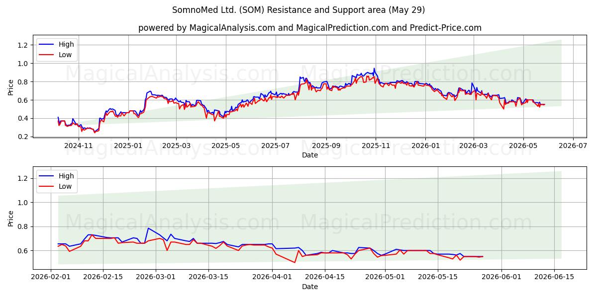  SomnoMed Ltd. (SOM) Support and Resistance area (28 May) 