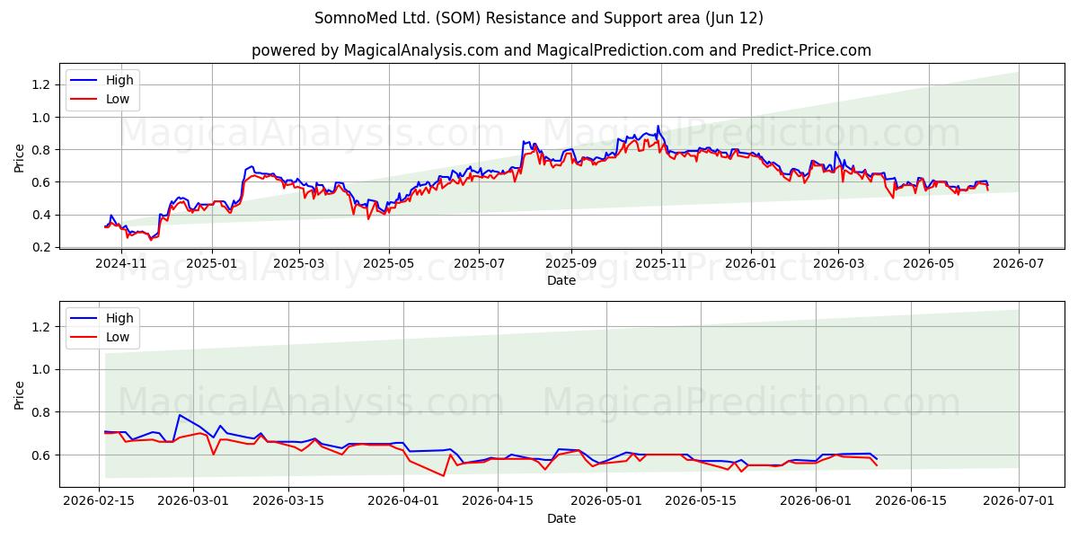  SomnoMed Ltd. (SOM) Support and Resistance area (11 Jun) 