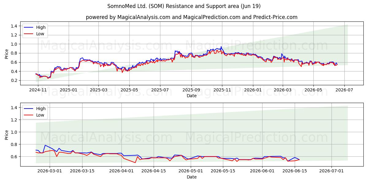 SomnoMed Ltd. (SOM) Support and Resistance area (18 Jun) 