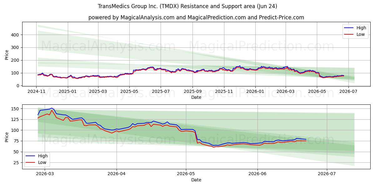  TransMedics Group Inc. (TMDX) Support and Resistance area (23 Jun) 