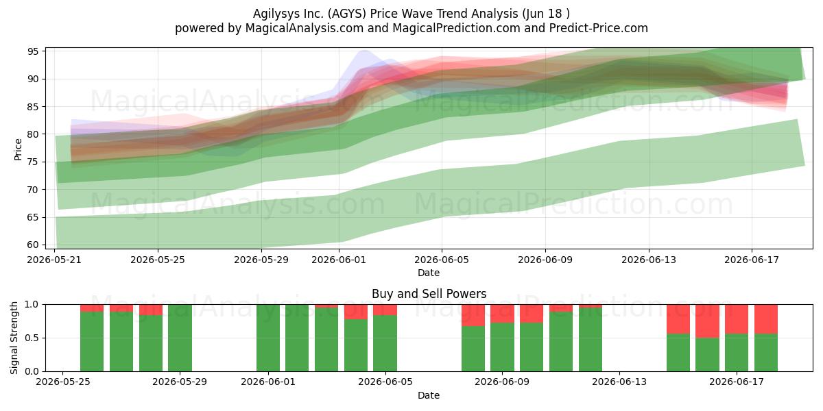  Agilysys Inc. (AGYS) Support and Resistance area (17 Jun) 