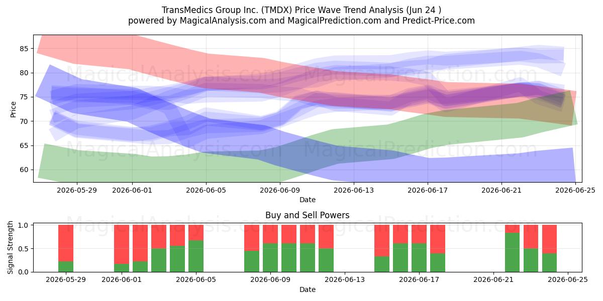  TransMedics Group Inc. (TMDX) Support and Resistance area (23 Jun) 